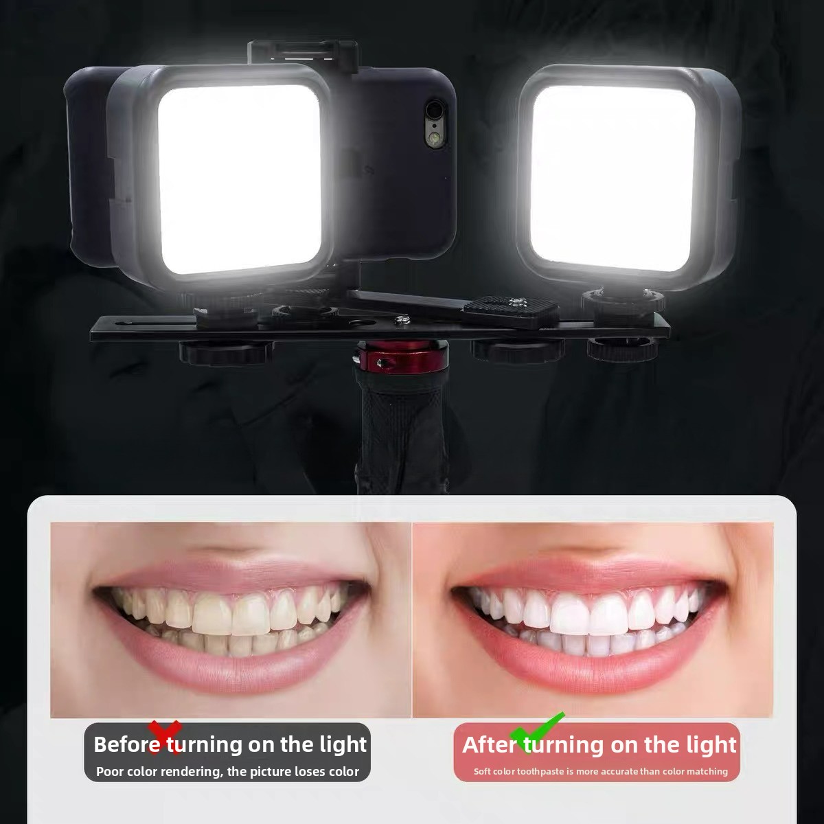 Photography Mobile Lighting - ไฟถ่ายภาพทางทันตกรรมพร้อมบลูทูธ ไฟส่องสว่างสำหรับถ่ายภาพช่องปาก ไฟฉาย LED สำหรับตรวจฟัน รักษาฟัน